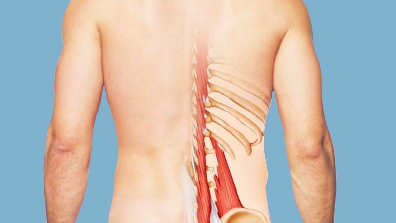Myositis als Ursache von Rückenschmerzen